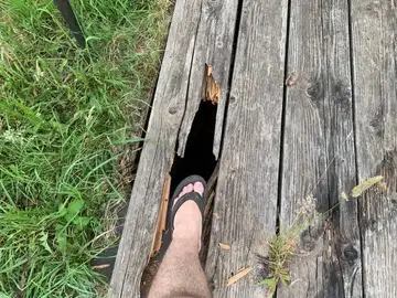 Stopalo na leseni brvi z veliko poškodbo